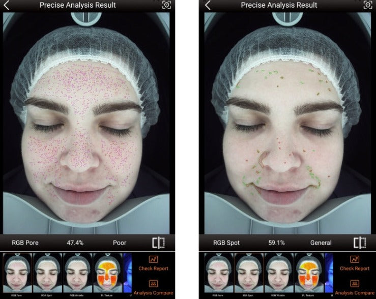 Zemits VeraFace ਚਮੜੀ ਵਿਸ਼ਲੇਸ਼ਕ ਪ੍ਰਣਾਲੀ