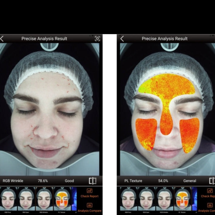 Zemits VeraFace ਚਮੜੀ ਵਿਸ਼ਲੇਸ਼ਕ ਪ੍ਰਣਾਲੀ