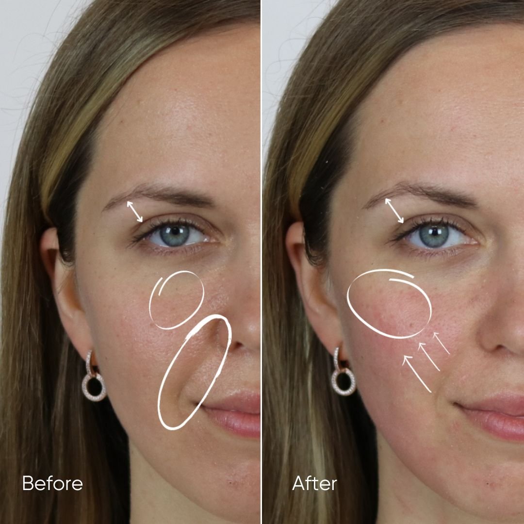 Zemits HydroVerstand PRO 7-ਇਨ-1 ਹਾਈਡ੍ਰੋਡਾਇਮੰਡ™ ਸਿਸਟਮ